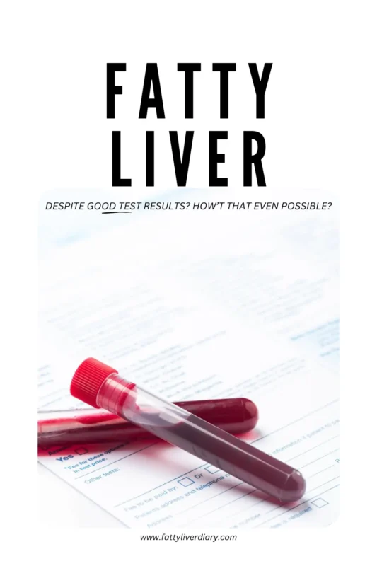 Fatty Liver with Good Blood Test Results Pinterest Pin