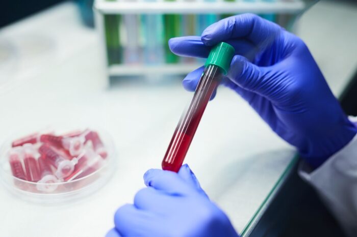 blood test tubes